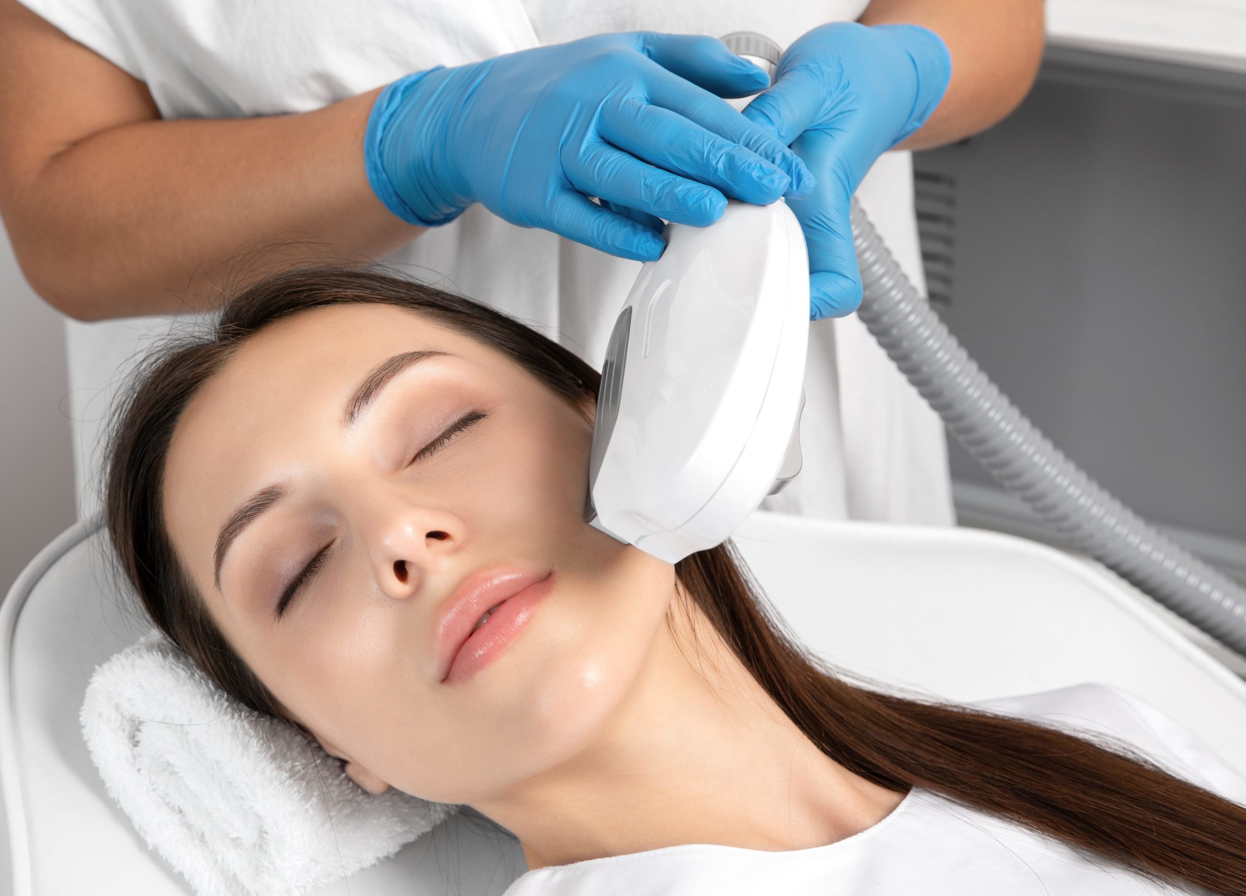 What are the Side Effects of IPL treatment?