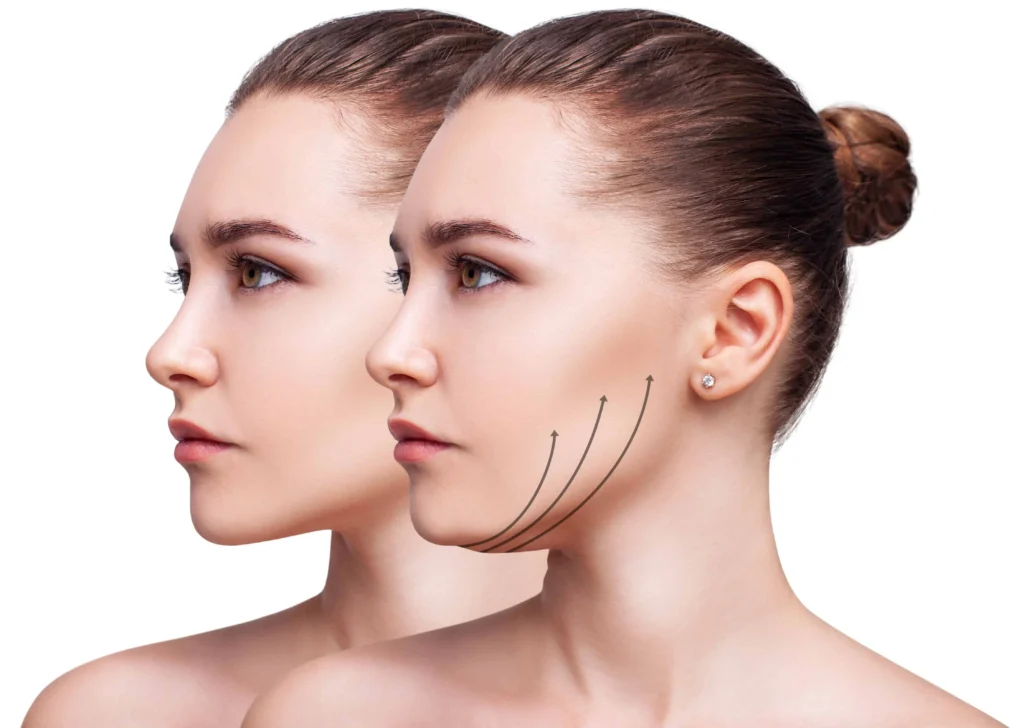 Woman's sculpted jawline | B Beautiful Med Spa | Laguna Hills CA