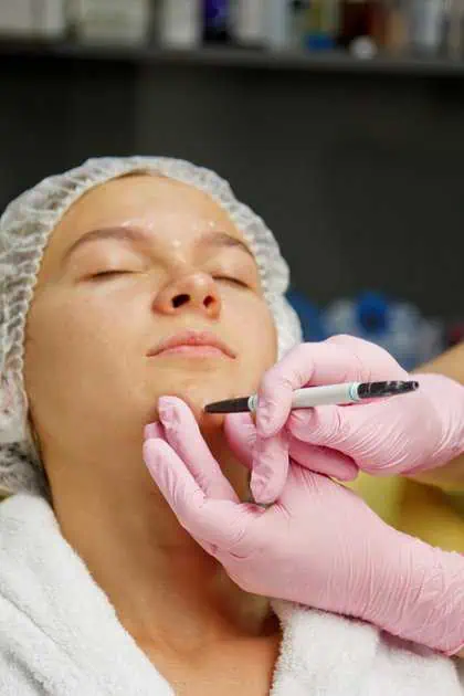 Kybella Treatment in Laguna Hills by B Beautiful Med Spa
