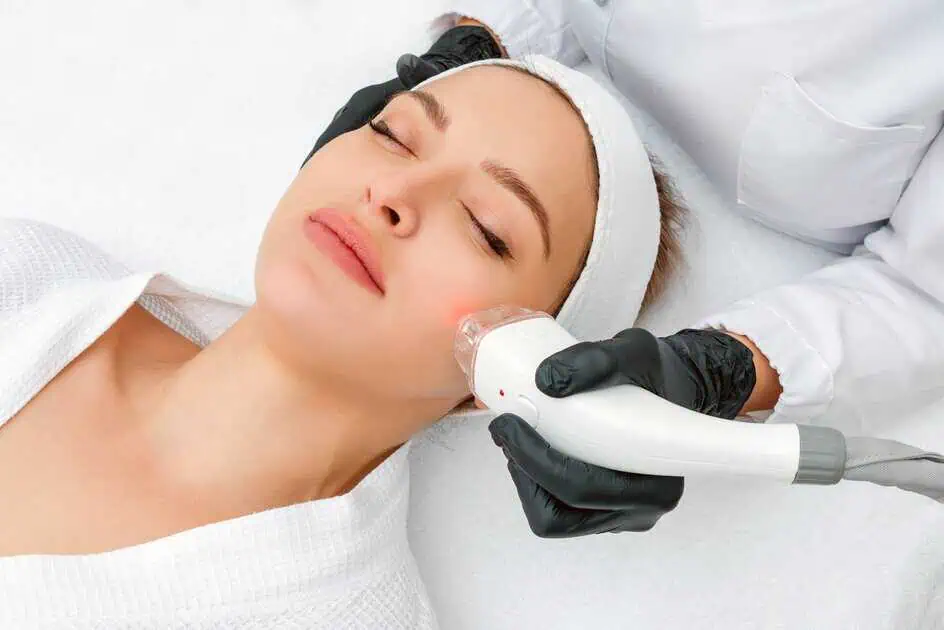 Erbium Yag Laser Treatment in Laguna Hills, CA – B Beautiful Med Spa