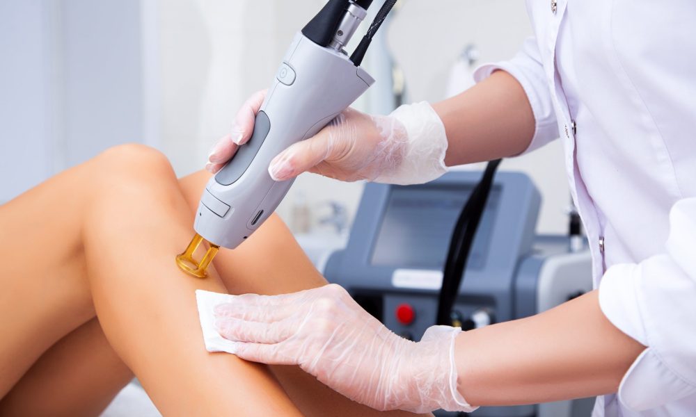 Say Goodbye to Unwanted Hair The Ultimate Guide to Laser Hair Removal